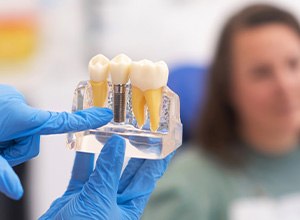 a gloved hand pointing to a model of a dental implant
