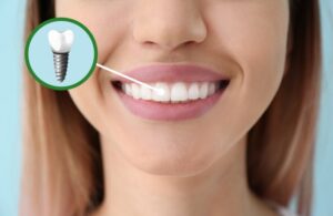 Woman smiling with a front tooth dental implant