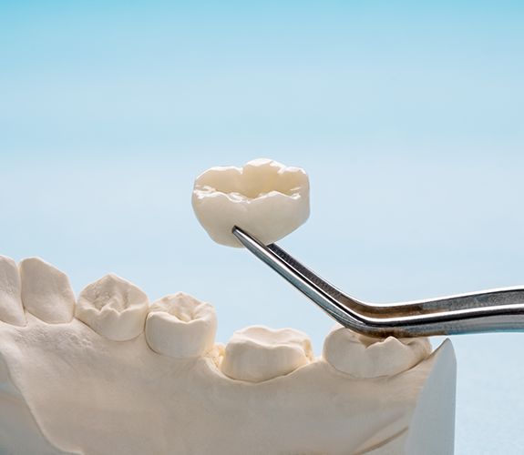 Tweezers holding a white dental crown